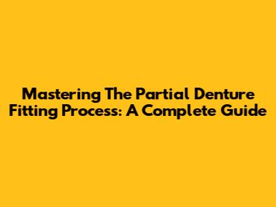 Mastering The Partial Denture Fitting Process: A Complete Guide