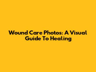 Wound Care Photos: A Visual Guide To Healing